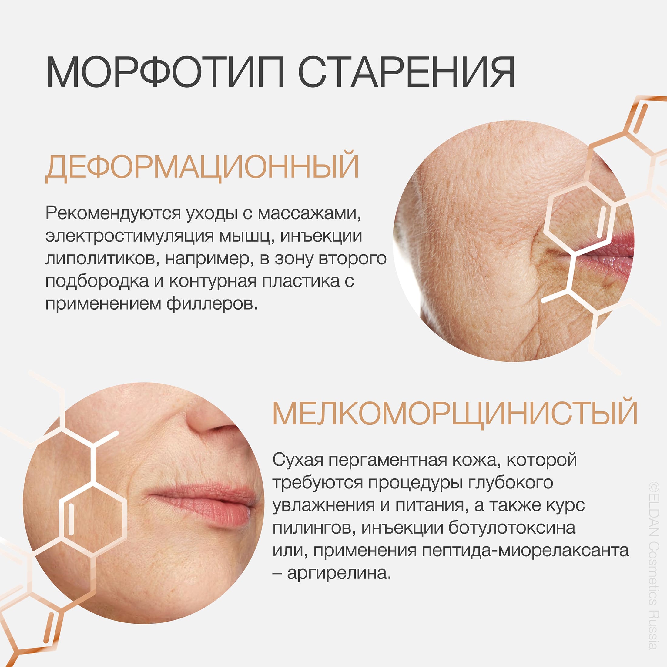 Пост генетика и кожа 3.jpg Пост генетика и кожа 3.jpg